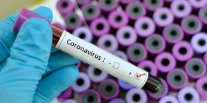 El departamento al que no le han analizado pruebas de coronavirus en 10 días