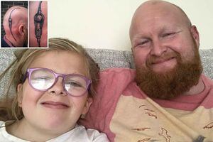 Este hombre se tatuó el cráneo para apoyar a su hija quien padece una rara enfermedad