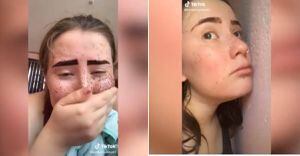 Mujer usó henna en su rostro para un reto de TikTok y todo salió mal