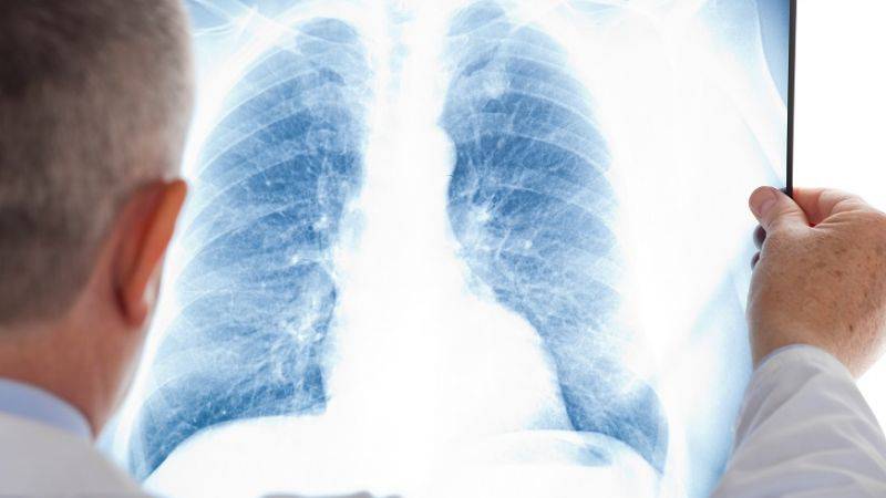Esta temporada, han prevalecido 4.500 muertes, 78.000 hospitalizaciones, por virus respiratorios.