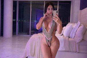 ¿Quién era Joselin Cano? 'La Kim Kardashian mexicana' que murió por una cirugía estética