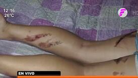Brutal ataque a mujer por difundir un chisme: la sentaron en brasero hirviendo