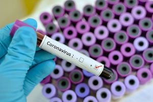 Aumentan a 513 casos de coronavirus y 21 muertes en P. R.