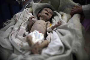Siria: las desgarradoras fotos de un bebé que muestran el rostro del hambre a causa de la guerra