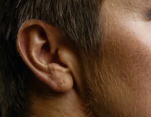 Pérdida de audición sería otro de los síntomas de Covid-19 ¿Cómo lo descubrieron?