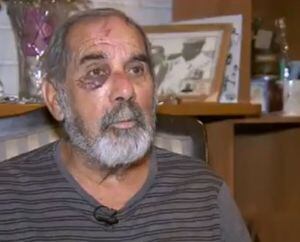 Desgarrador relato de hombre de 69 años golpeado por carabinero: “Actúan sin ningún criterio”