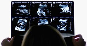 Expareja de un hombre abortó con siete meses de gestación y ahora denunciará el caso como homicidio