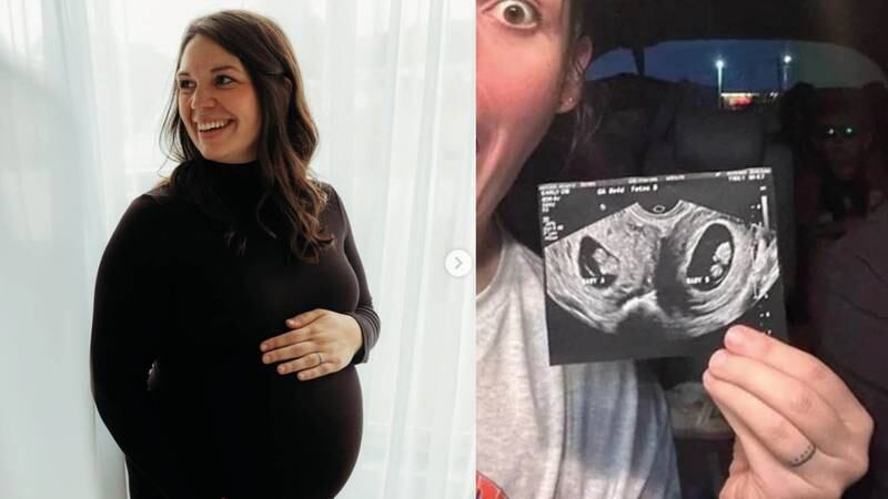 Mujer nació con dos úteros y quedó embarazada en ambos