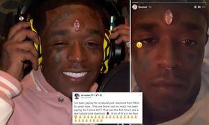 Vídeo: rapper implanta diamante cor-de-rosa de quase 130 milhões de reais na testa