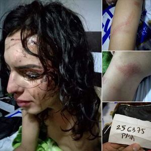 Policías habrían golpeado brutalmente a mujeres trans en Bogotá