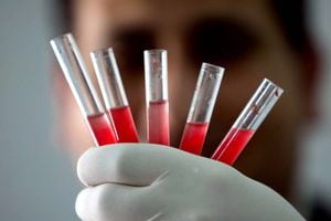 Coronavirus: personas con sangre tipo A tendrían mayor probabilidad de contagiarse, según estudio