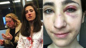 Quatro adolescentes são presos por ataque a casal em ônibus de Londres