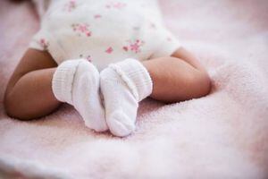 Bebé sufrirá amputación tras quedar hilo de su calcetín enredado a su pie: su mamá no se había dado cuenta porque llevaba una semana sin bañarla