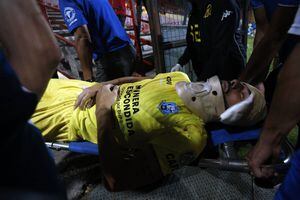 Antofagasta pierde a su figura: Paulo Garcés sufre fractura nasal tras fuerte choque con Sebastián Jaime