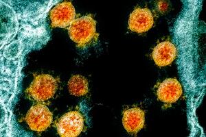 Nueva Zelanda está cerca de erradicar el coronavirus