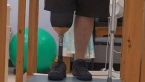 Diabetes: "Me amputaron la pierna porque no me atendí mi diabetes tipo 2"