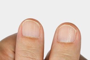 Detecta enfermedades con solo ver tus uñas
