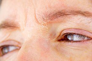 Recomendaciones para prevenir síndrome de ojo seco