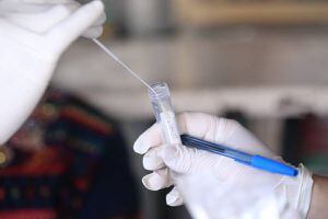 Se confirman 47 mil 605 casos acumulados de coronavirus