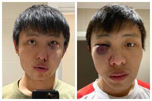 “No quiero tu coronavirus en mi país”: joven de 23 años de Singapur fue agredido en Londres sólo por tener “rasgos asiáticos”