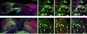 Prueban con éxito terapia génica para regenerar las neuronas pérdidas en accidentes cerebro vasculares