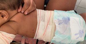 Cliente de bar joga rojão em bebê de 6 meses após ser questionado por não usar máscara, em Goiás