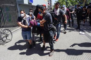 ¿Militares y carabineros están apuntando a los ojos? Colegio Médico en alerta por cantidad de manifestantes que terminan con estallidos oculares por culpa de balines