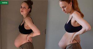 Mãe de trigêmeos mostra os efeitos reais da maternidade