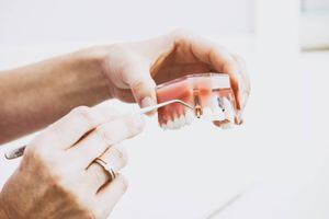 ¿Te van a poner un implante dental? Todo lo que debes saber