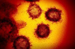 FDA aprueba primera prueba casera de coronavirus