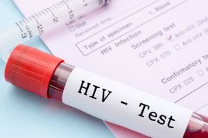 Estudio: VIH indetectable es igual a cero probabilidad de transmisión