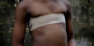 Planchado de senos, la dolorosa técnica para "evitar" violaciones hacia las mujeres