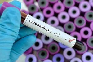 Tras declaración de la OMS por el coronavirus: ¿Qué es una pandemia?