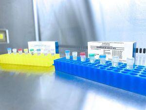 SP vai ampliar rede de testes para o coronavírus