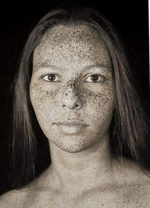 Fotógrafo revela os danos invisíveis que o sol produz na nossa pele com fotos ultravioletas