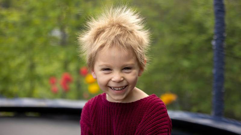 Niño que padece del síndrome de cabello impeinable