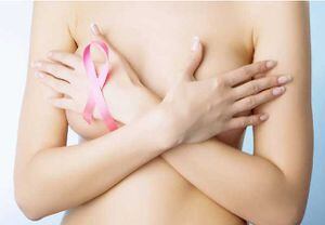 Estos son los signos y síntomas del cáncer de mama que jamás debes ignorar