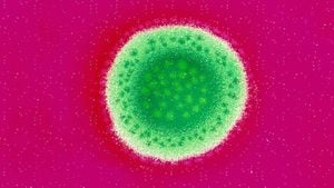 Fiebre de Lassa: la enfermedad mortal que se está extendiendo rápidamente y para la que no hay vacuna