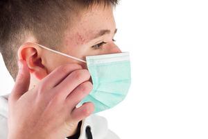 "Maskne": una forma de acné causada por la pandemia