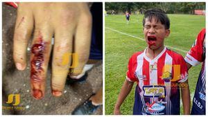 FOTOS. Sangrienta paliza a un jugador de la Tercera División