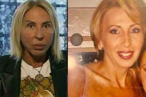 La transformación de Laura Bozzo antes y después de las cirugías