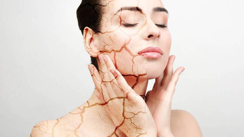 Consecuencias de no usar una humectante acorde a tu de piel – Metro World News