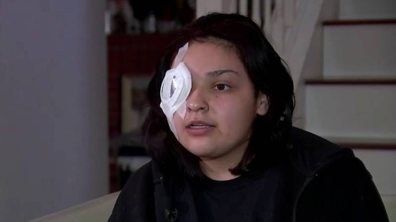 Joven perdió el ojo tras salvar a un discapacitado | Foto: Telemundo