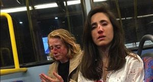 Una pareja de chicas sufre brutal ataque homofóbico en un autobús