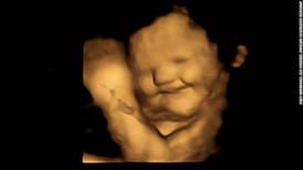 Nuevo estudio revela como los fetos sonríen en las ecografías gracias a las verduras