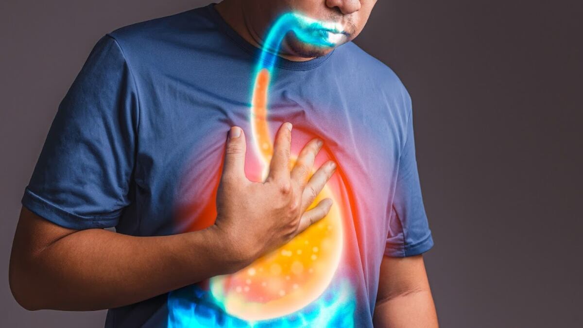 En algunas ocasiones, es suficiente tomar antiácidos para detener el reflujo gastroesofágico.