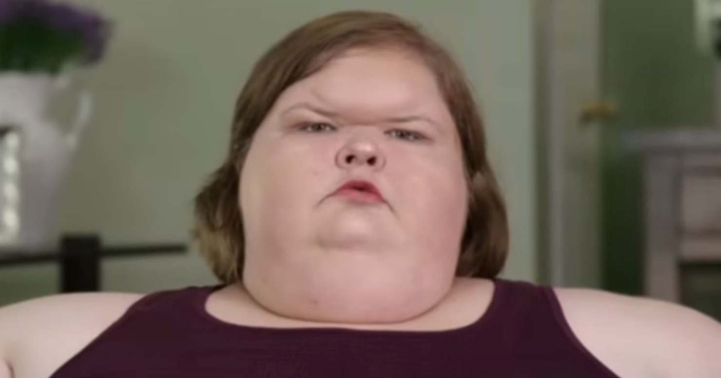 Tras bajar más de 200 kg, una de las hermanas de Kilos Mortales mostró el resultado de su cirugía de eliminación de piel.
