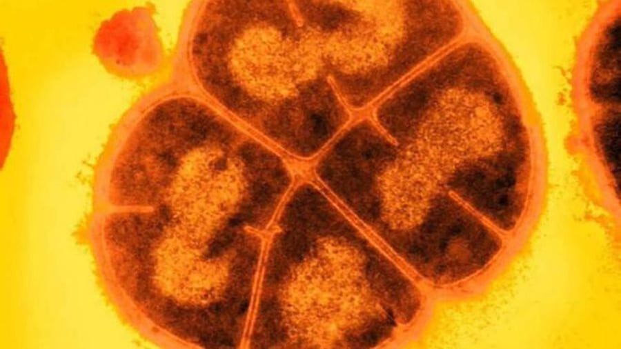 Bacteria poliextremófila | Imagen: Archivo