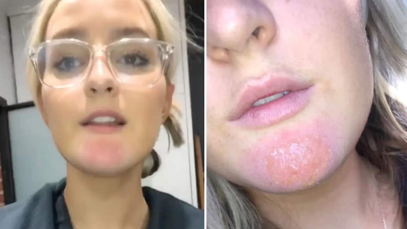 Tiktoker alerta por la falta de higiene en las barbas de los hombres.