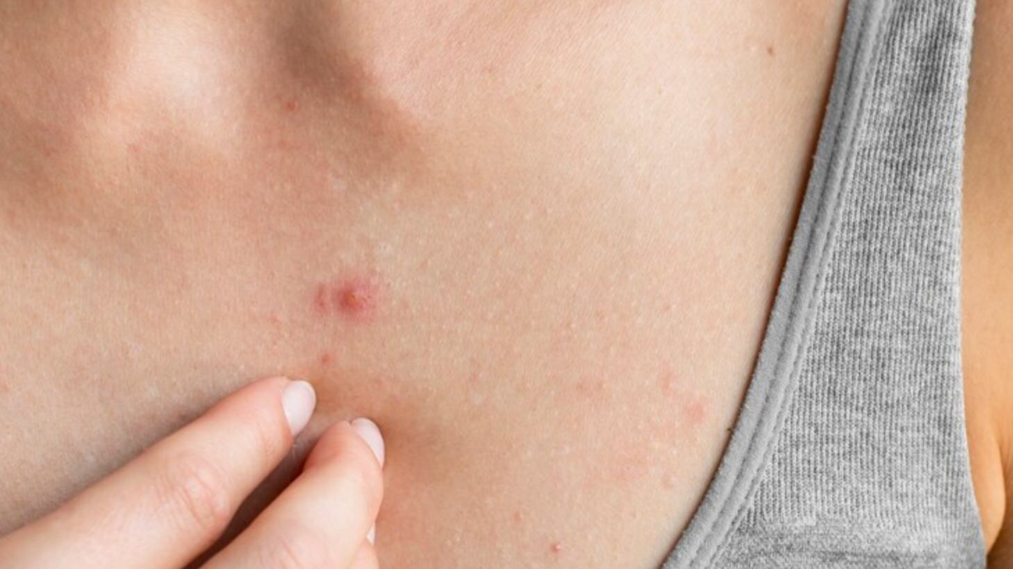 Ten todas las precauciones